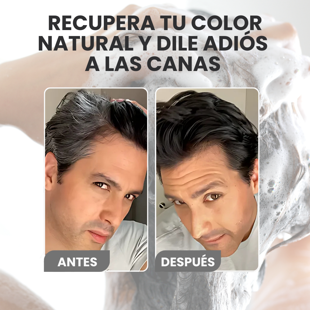 VITABLACK ANTICANAS™| ¡ELIMINA LAS CANAS Y LUCE HASTA 10 AÑOS MÁS JOVEN EN 10 MINUTOS!