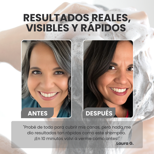 VITABLACK ANTICANAS™| ¡ELIMINA LAS CANAS Y LUCE HASTA 10 AÑOS MÁS JOVEN EN 10 MINUTOS!
